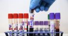 Russian sites call HIV a myth, Western conspiracy�an epidemic is now exploding
