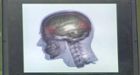 NHL, parents need to teach kids about concussions