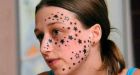 Belgian girl's tattoo 'nightmare'