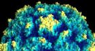 Polio case reported in Russia