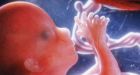 Marie Stopes Runs TV Abortion Ads in U.K.