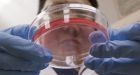Family fights for research on rare genetic disease
