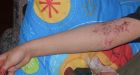 A mother's plea to help her ill son