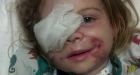 KFC worker allegedly asked girl with pit bull scars to leave eatery