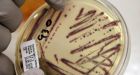 Superbug gene found in animals and people in China alarms scientists