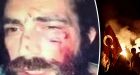 French tourist beaten up by Turkish nationalists after refusing to hold Turkey flag